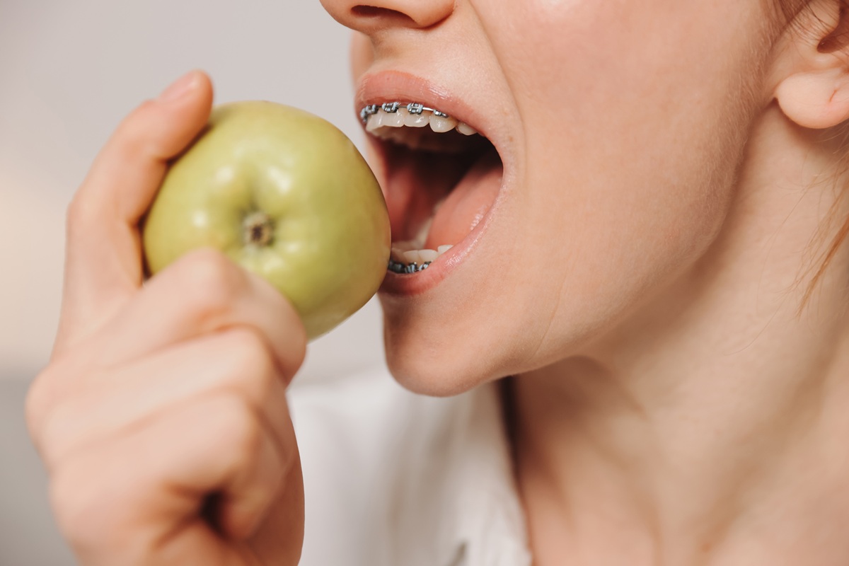 dieta przy aparacie na zęby